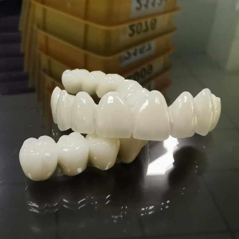 Arvoton PFM