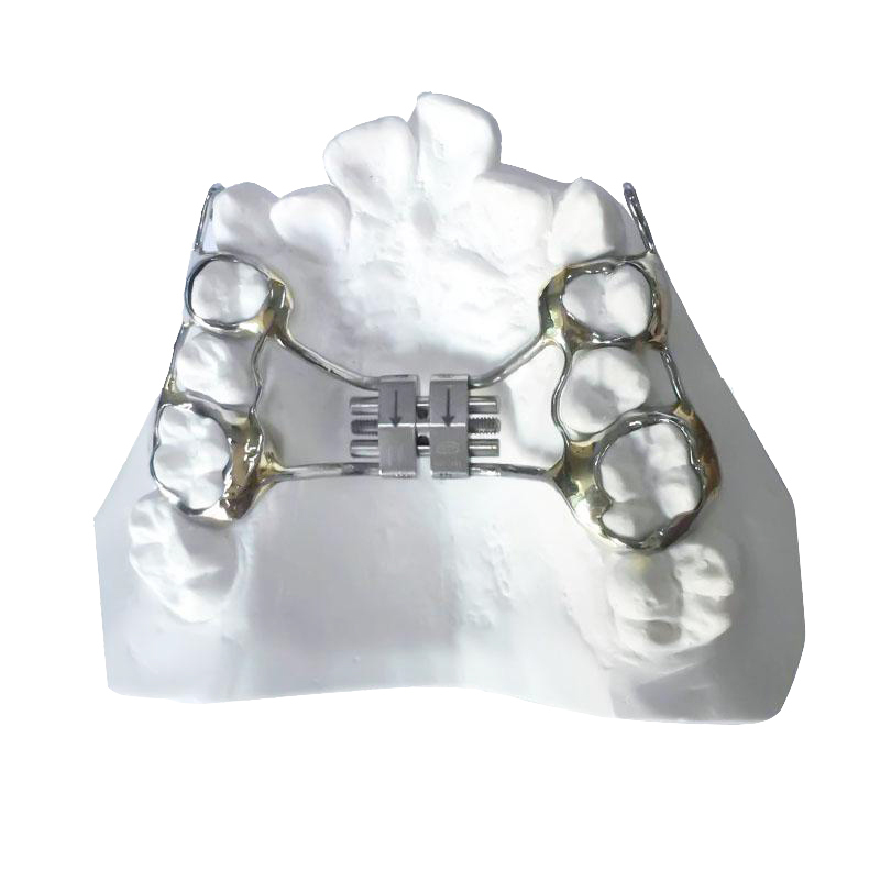 Rapid palatal Expander