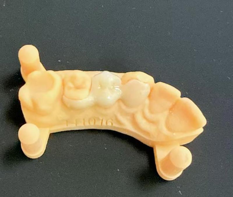 Mitä sinun tulee tietää Maryland Bridgesistä?