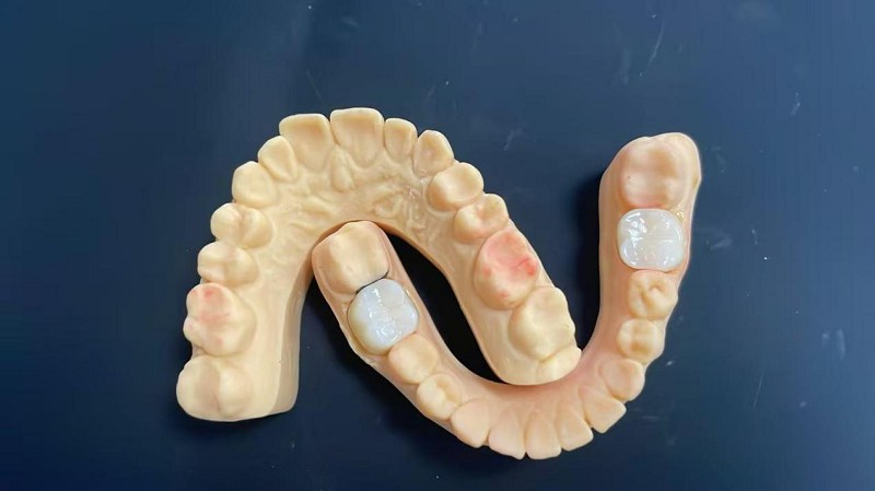 Mikä on olkapään reuna?