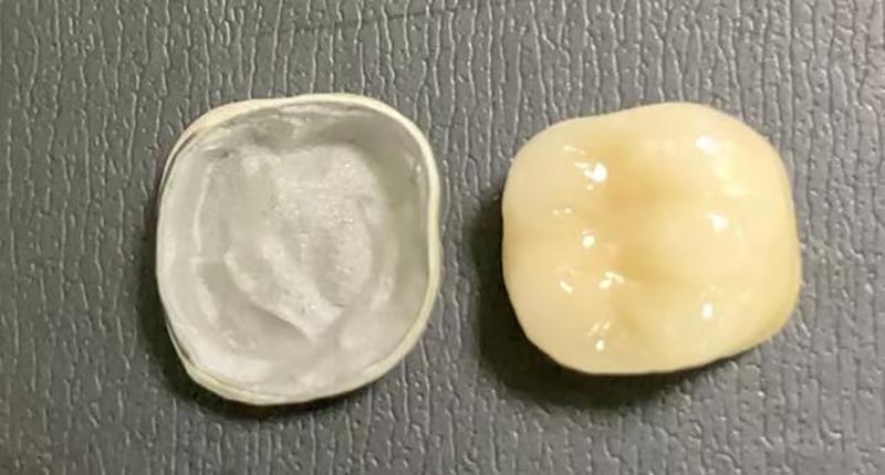 WM DENTAL LAB – Johtava kiinalainen hammaslaboratorio