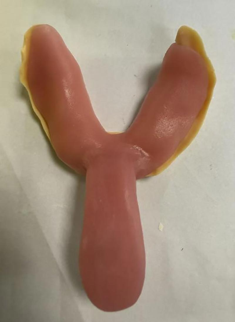 Asiat, joita et tiennyt mukautetuista hammashoitoalustasta