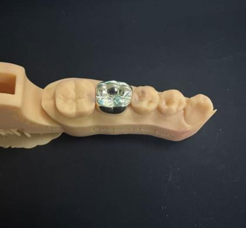 NPG gold-tone aesthetic dental teeth