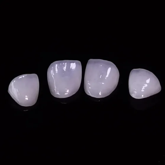 High Esthetic Emax Veneers