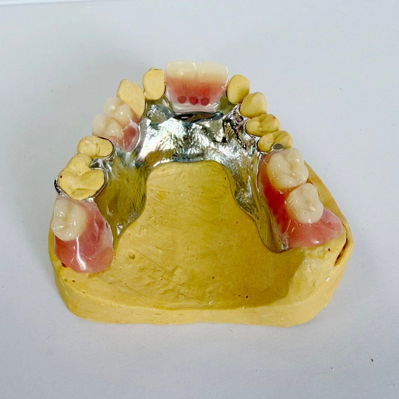 Irrotettava entisöintikehys